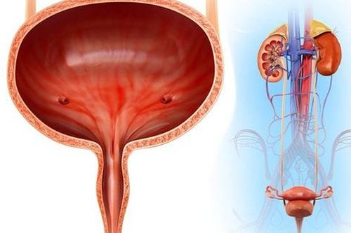 Thói quen xấu gây sỏi bàng quang