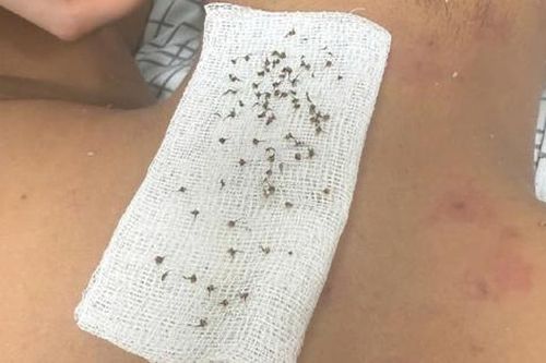 Hai bố con ngất xỉu khi đi tìm tổ chim, đến viện bác sĩ chỉ ra nguyên nhân 'đáng sợ'