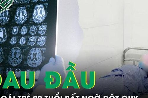 Cô gái 20 tuổi đột quỵ sau 2 ngày đau đầu dữ dội