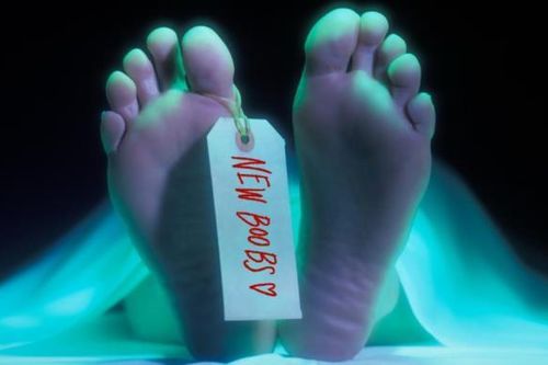 Tiêm mỡ từ người chết - cơn sốt thẩm mỹ gây tranh cãi nhất hiện nay