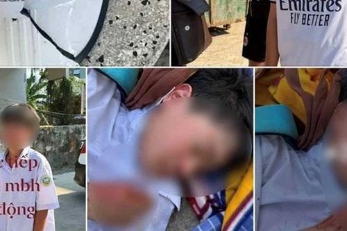 Công an vào cuộc vụ học sinh lớp 6 bị đánh hội đồng ở Nha Trang