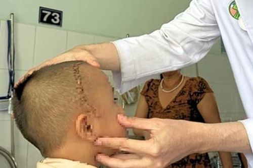 Bé 4 tuổi sưng mắt, báo sĩ sốc khi phát hiện bí mật bên trong