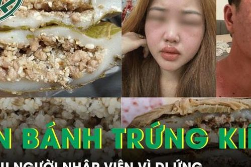 Trào lưu ăn bánh trứng kiến gây sốt mạng xã hội, nhiều người nhập viện vì dị ứng