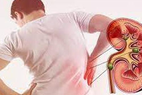 Sỏi thận có thể tự đào thải trong bao lâu, khi nào cần can thiệp?