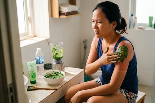 Da cháy nắng và cách dùng rau mồng tơi để xử lý