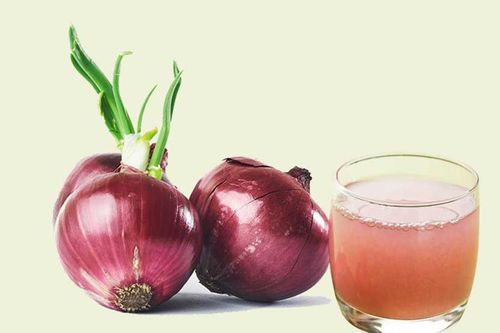 Nước ép hành tây có giúp tóc mọc nhanh hơn?