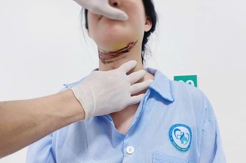 Nữ sinh nhập viện vì vướng dây điện trên đường đi học về