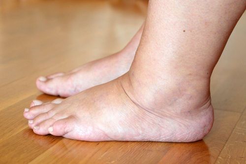 Thói quen hại gan nhanh 'một chín một mười' với rượu bia