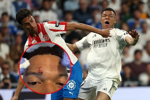 Mbappe gây lo lắng