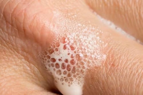 Oxy già bị quay lưng