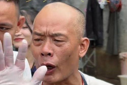 Bàn tay biến dạng của chủ quán lẩu gà xin khách đừng tới viral MXH