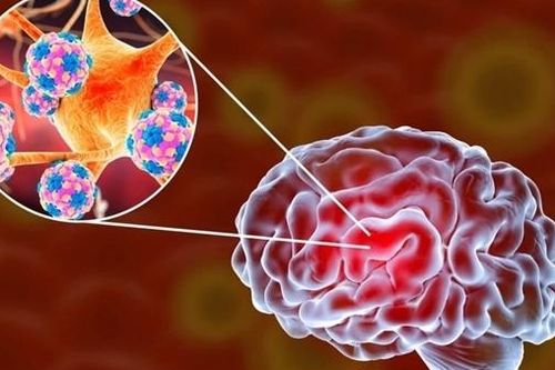 Bộ Y tế khuyến cáo bệnh viêm não mô cầu sau 4 trường hợp tử vong
