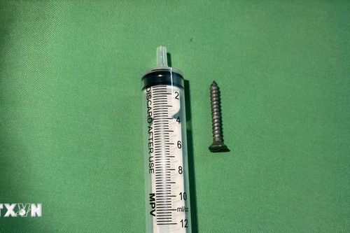 Quảng Trị: Cứu thành công bé 21 tháng tuổi nuốt đinh vít sắc nhọn dài 2,5cm