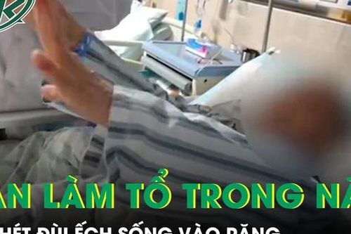 Nhét đùi ếch sống vào răng, người phụ nữ 61 tuổi bị sán ký sinh, làm tổ trong não