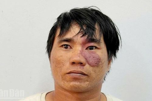 An Giang khởi tố bị can cố ý gây thương tích dẫn đến chết người