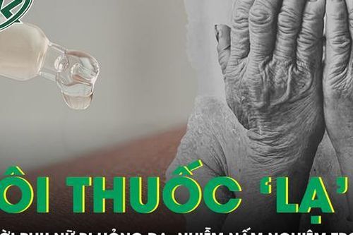 Người phụ nữ bị hỏng da, nhiễm nấm nghiêm trọng sau khi bôi 'thuốc lạ'
