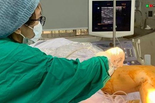 Người cao tuổi đau, tê chân kéo dài… cảnh giác tắc động mạch chi nguy hiểm