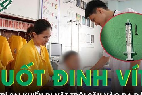 Bé 21 tháng tuổi nuốt đinh vít, người nhà xử trí sai cách khiến dị vật trôi sâu vào dạ dày