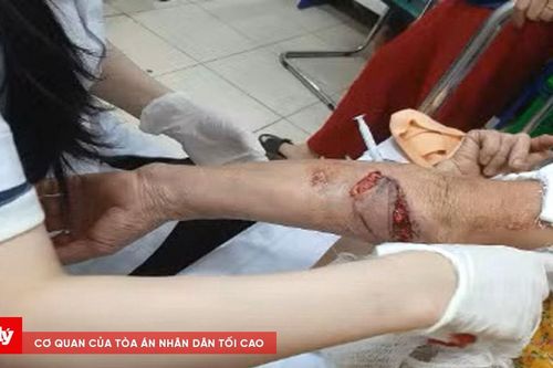 Chó lạ tấn công người đi tập thể dục