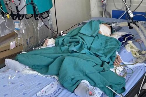 Nuốt nhầm hóa chất thí nghiệm, bé 2 tuổi nhập viện lọc máu