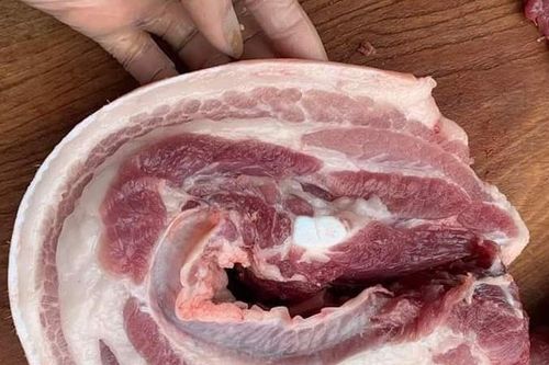 Nguy kịch vì thói quen chế biến thịt sống nhiều người mắc phải
