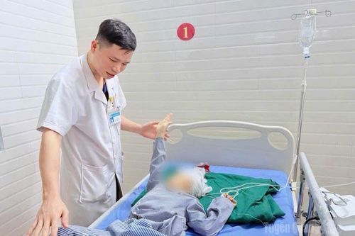 Cấp cứu kịp thời bệnh nhi 51 tháng tuổi chấn thương sọ não do ngã nhà sàn
