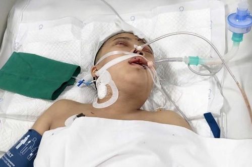 Vợ mất vì ung thư, con gái nguy kịch sau tai nạn, cha nghèo cầu cứu