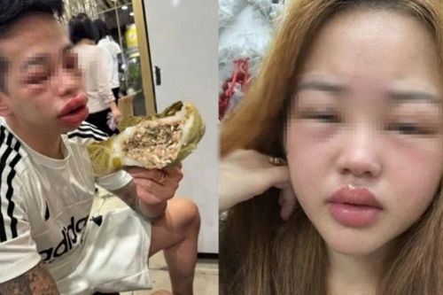 Thói quen dễ dãi với thực phẩm