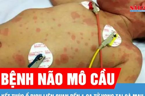 Kết thúc ổ dịch bệnh não mô cầu liên quan đến 1 ca tử vong ở Cà Mau