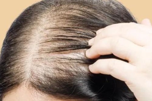 5 thói quen gây hại khiến tóc ngày càng mỏng đi