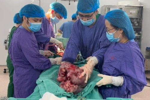 Chủ quan, người bệnh để khối u âm thầm phát triển chiếm gần hết ổ bụng