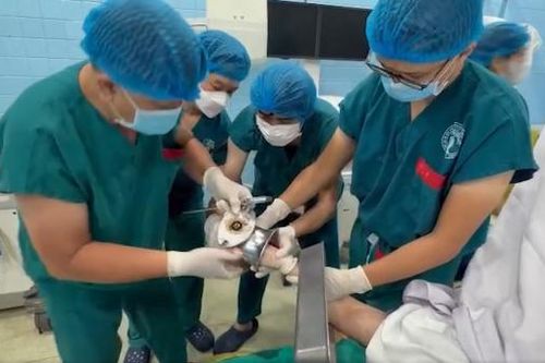 Nữ tiểu thương bị máy xay thịt cuốn nát bàn tay