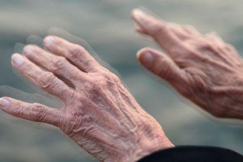 Dấu hiệu đường ruột giúp phát hiện sớm nguy cơ Parkinson