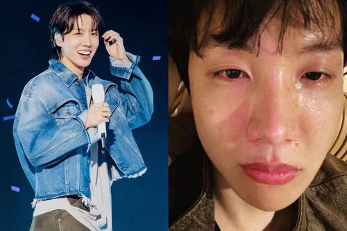 J-Hope (BTS) đăng ảnh nước mắt giàn giụa, gương mặt sưng húp khiến fan xót xa