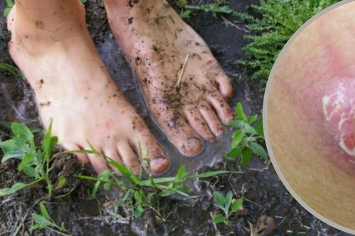 Bộ Y tế khuyến cáo bệnh từ bùn đất dễ bùng lên sau mưa lũ