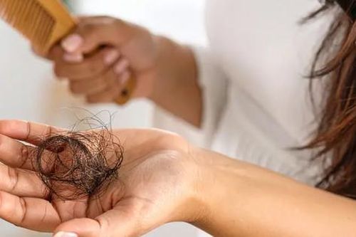 Tại sao tóc rụng nhiều?