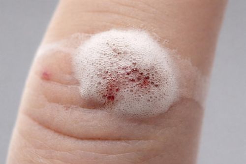 Vì sao oxy già hết thời?