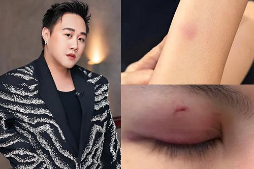 5 vụ sao Việt đánh người: Người thừa nhận say rượu, kẻ bị tát giữa phim trường