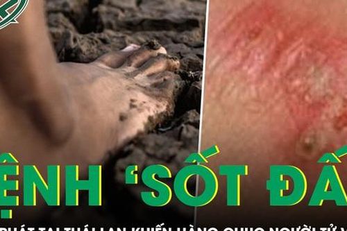 Bệnh 'sốt đất' bùng phát tại Thái Lan khiến hàng chục người tử vong