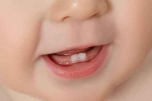 Trẻ chậm mọc răng: nguyên nhân và dấu hiệu cần lưu ý