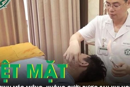 Nam sinh méo miệng, không cười được sau khi ngủ dậy