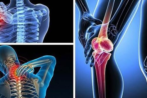 Không vận động mạnh tại sao vẫn bị thoái hóa?