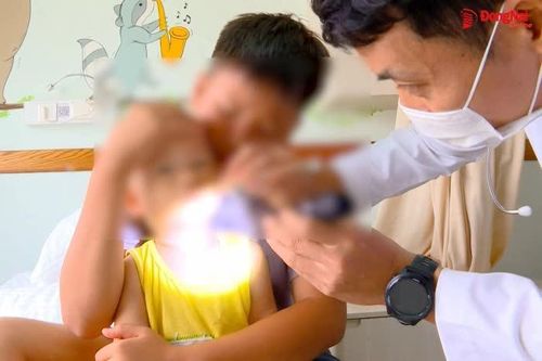 [Video] Bệnh tay chân miệng tăng 2,7 lần: Nhiều ca nhiễm chủng virus có nguy cơ gây biến chứng nặng