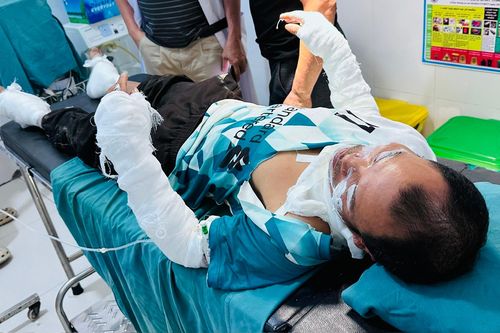 Tai nạn kinh hoàng khi thui thịt chó bằng bình gas