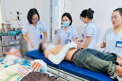 Thui thịt chó, 2 người đàn ông bỏng nặng