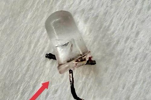 Bé 9 tháng tuổi ho nhiều ngày, bố mẹ 'sốc' khi bác sĩ gắp ra đèn LED nằm trong phế quản
