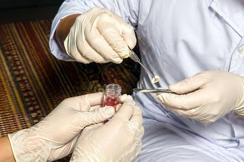Bệnh viện Đa khoa Bắc Ninh số 1 tiếp nhận ca hiến giác mạc đầu tiên