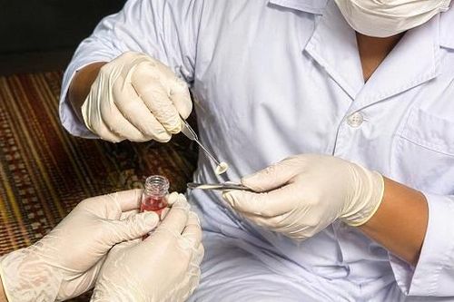 Ca hiến giác mạc đầu tiên tại Bệnh viện Đa khoa Bắc Ninh số 1