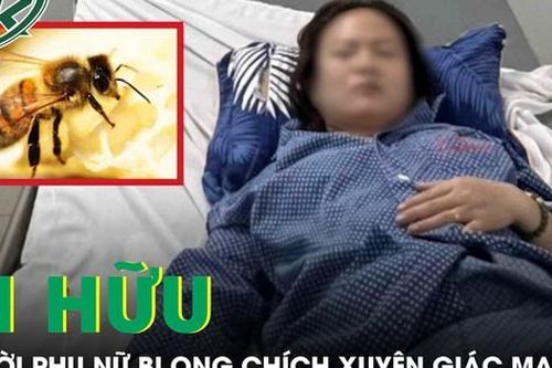 Ong chích xuyên giác mạc, người phụ nữ sưng phù mắt phải cấp cứu khẩn