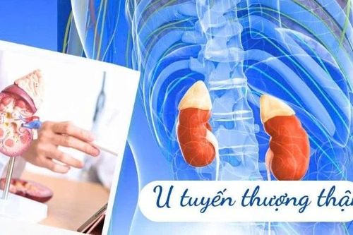 U tuyến thượng thận – khối u nhỏ nhưng hậu quả khôn lường
